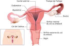IMAGE CANCER UTERIS.jpg